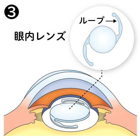 こころがける17_3