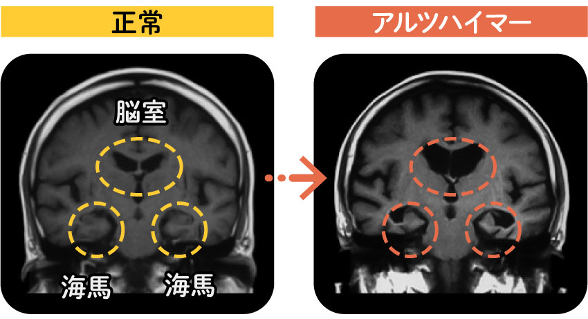 基礎1_1