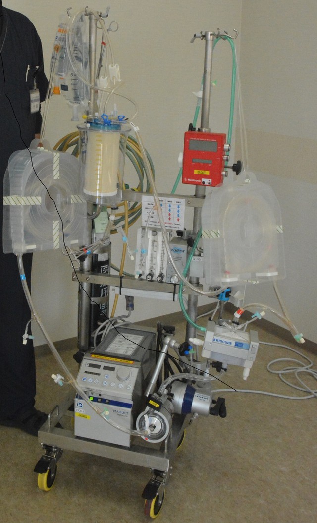 重症监护中使用的人工肺(ecmo)=摄于2月22日  (三上元)