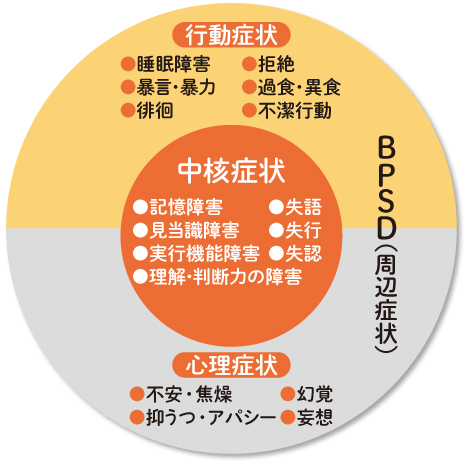 認知症で見られる症状