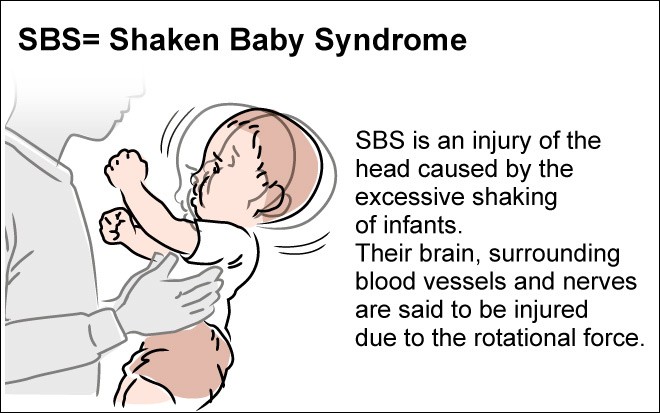 Latest court fight weighing shaken baby syndrome starts in Tokyo ...