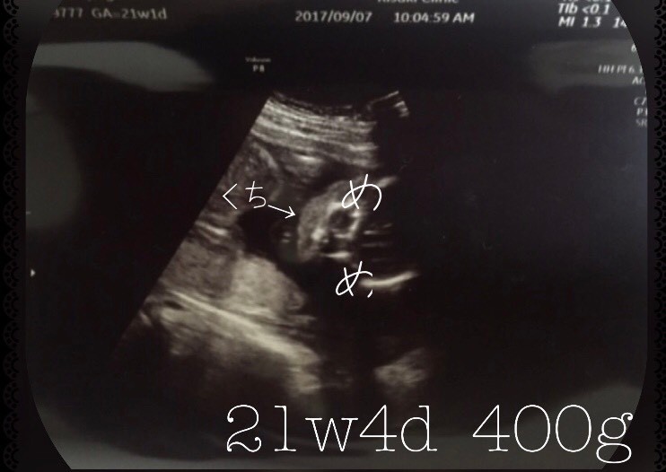 この家では産めない 18歳でホームレス妊婦に 支援受けられず公園で過ごした日々 コロナ禍の今伝えたいこと まいどなニュース この家では産めない 18歳でホームレス妊婦に 支援受けられず公園で過ごした日々 コロナ禍の今伝えたいこと まいどなニュース