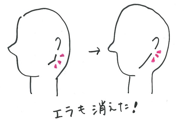 あのイケメン俳優も実践 輪ゴムで小顔に むくみが取れて目もパッチリの裏ワザって まいどなニュース