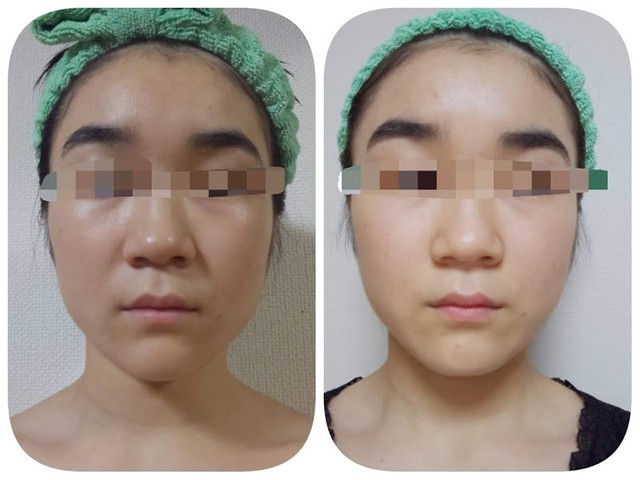 アイドル育成講師から聞く Snsで話題のアイドル級 小顔マッサージ を1週間試してみた まいどなニュース