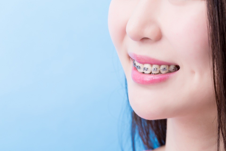 コロナ禍で増えている大人の歯列矯正治療 注目は着脱できる マウスピース矯正 まいどなニュース